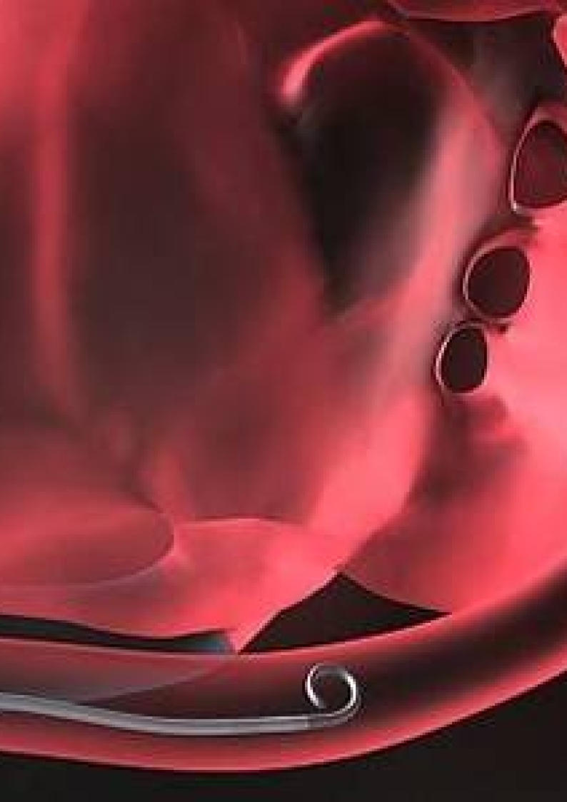 CardioBridge
