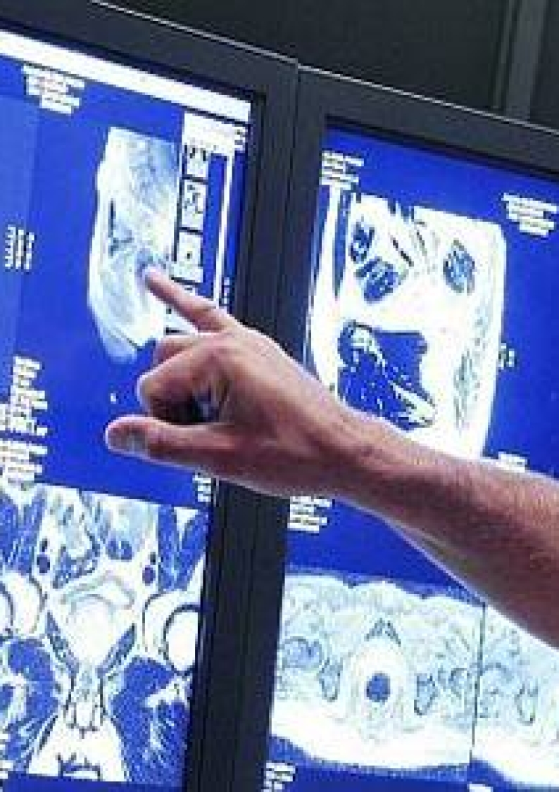 Agfa Healthcare
